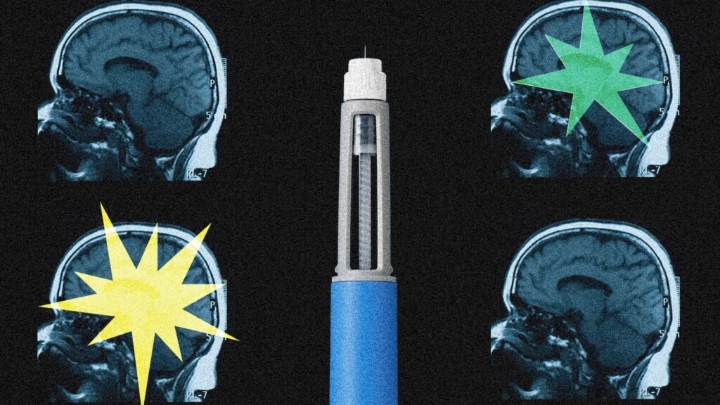 Beyond Appetite: How Ozempic and GLP-1 Drugs Are Quietly Rewiring the Human Brain